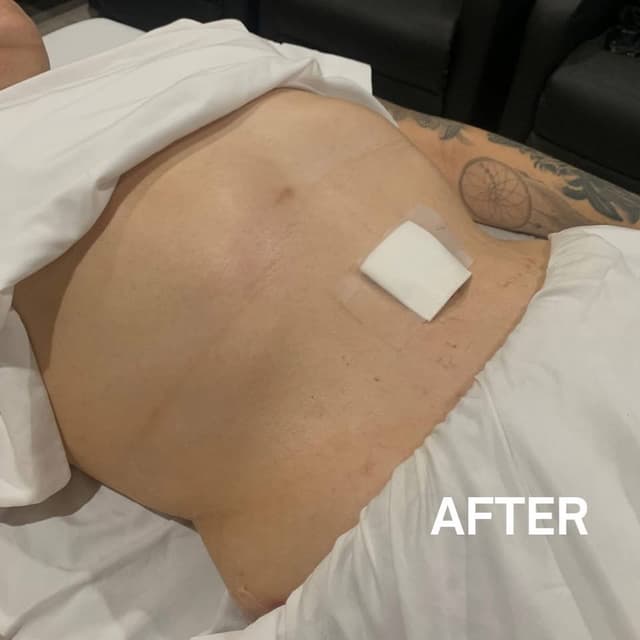Lymphatic Detox- 5 Sessions at THAE Beauty Studio in Houston, TX